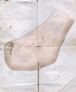 Medical drawing of left foot having been operated